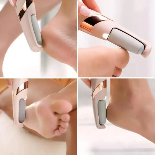 Electric Foot Callus Remover | Rechargeable Pedicure Tool for Soft Feet🌸 - Trendigo